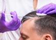 Benefits of Hair PRP tratment in Pune