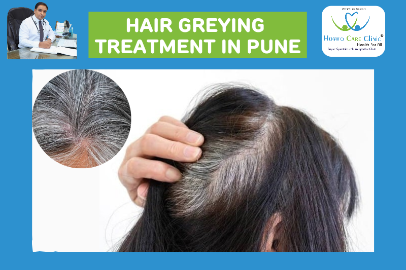 Natural homeopathic remedies to reverse early greying of hair Homeopathic treatment for premature grey hair using natural remedies