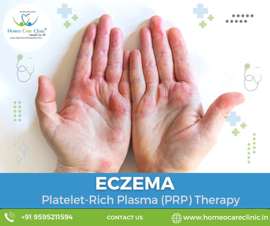 Discover the hopeful path of eczema recovery with PRP therapy. PRP therapy for natural eczema relief.