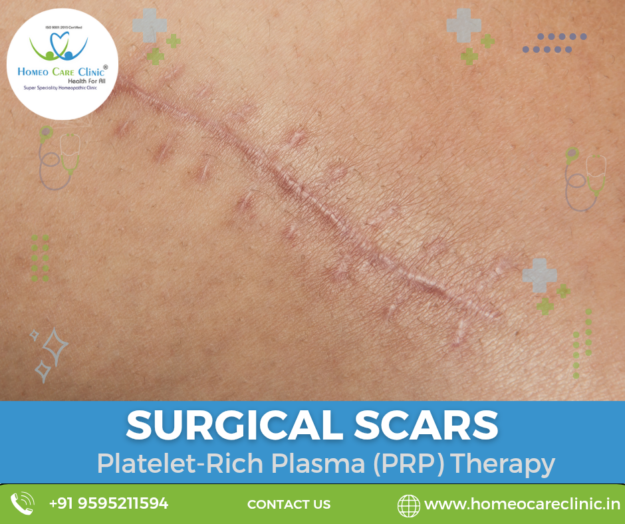 PRP therapy benefits for surgical scars.