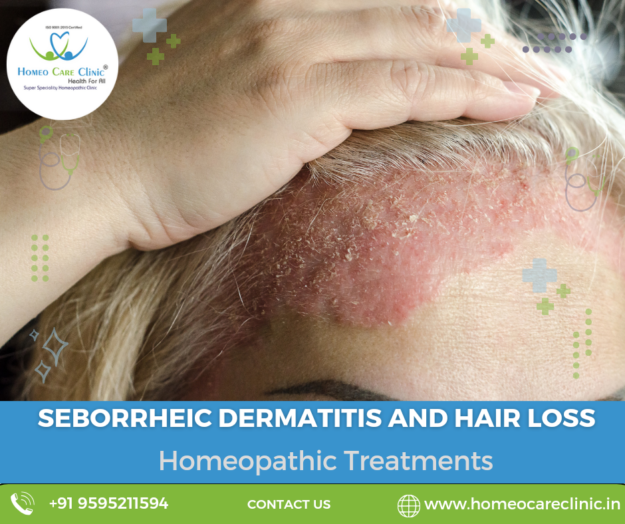 seborrheic dermatitis causes hair loss seborrheic dermatitis PRP treatment