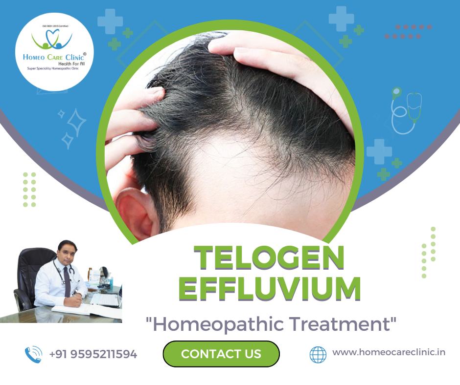 Natural Ways to Treat Telogen Effluvium and Hair Loss Natural remedies for Telogen Effluvium hair loss
