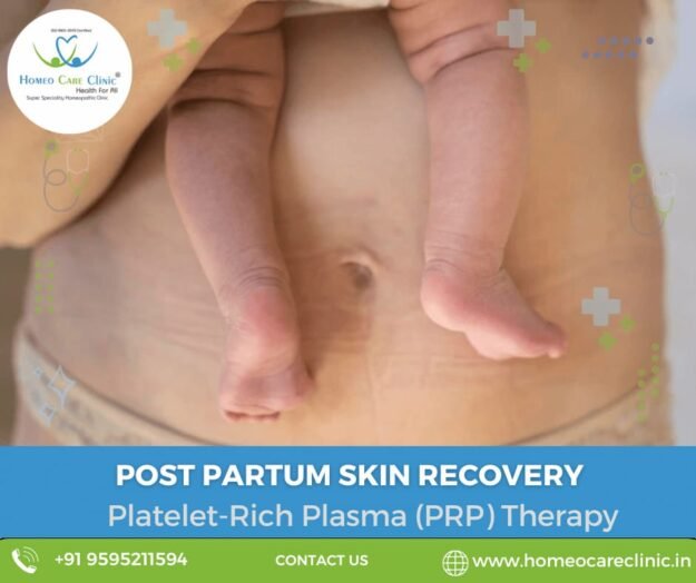 PRP therapy and homeopathy in treating postpartum PRP therapy and homeopathic remedies for postpartum skin recovery