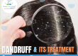 Dandruff Treatment in Pune