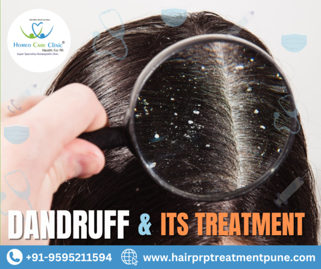 Prevent and Remove Dandruff Dandruff Treatment in Pune
