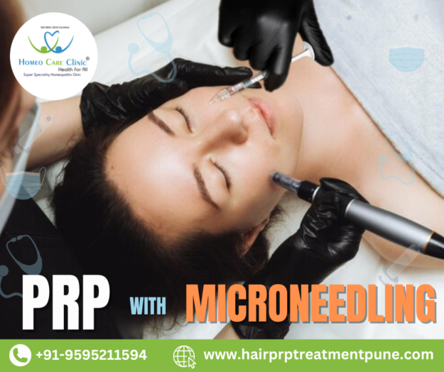 PRP with Microneedling for Skin Rejuvenation Microneedling with PRP for wrinkles and acne scars treatment