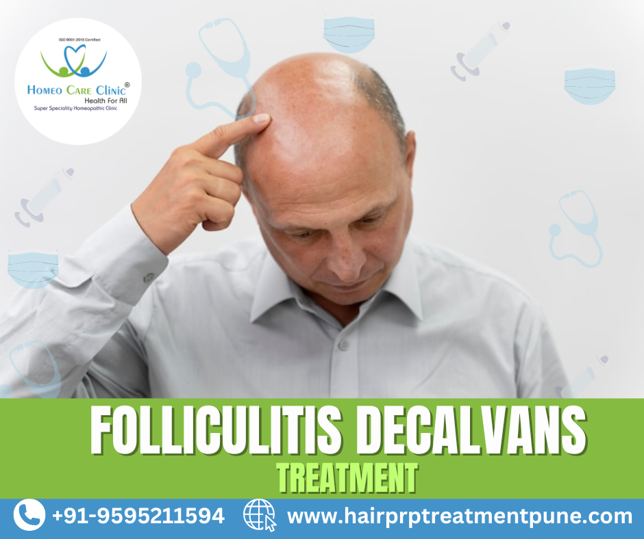PRP therapy for hair regrowth in Folliculitis Decalvans patients.
