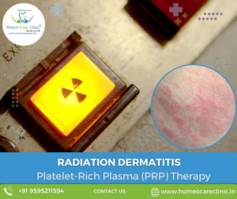 PRP and homeopathy for radiation dermatitis PRP and homeopathy for treating radiation dermatitis