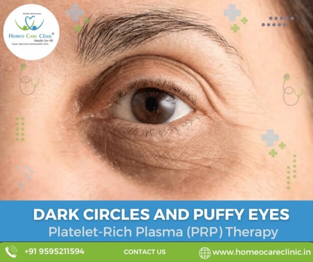 Natural treatment for dark circles and puffy eyes