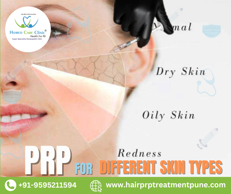 PRP for Different Skin Types PRP treatment benefits for different skin conditions.
