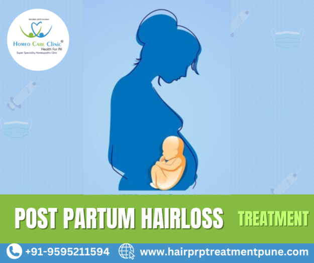 postpartum hair loss causes and PRP treatment Postpartum hair loss treatment with PRP