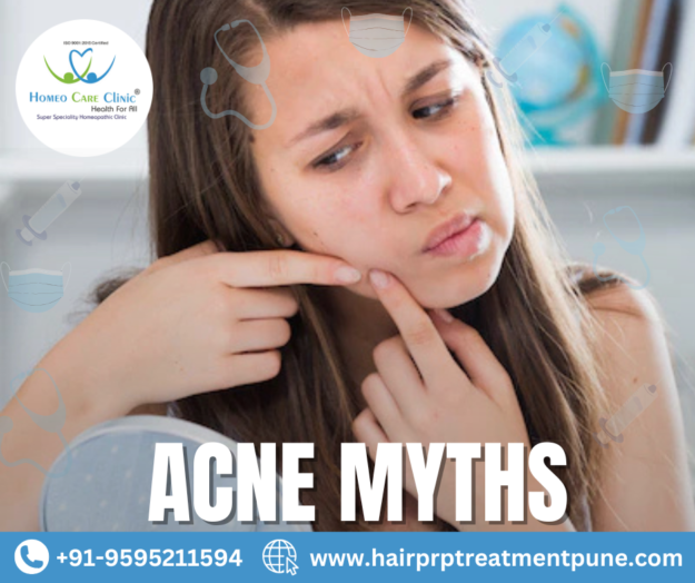 Acne myths and facts with PRP treatment