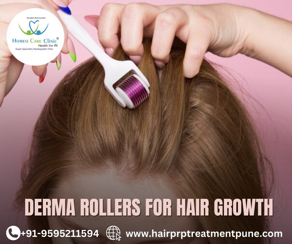 Derma roller and PRP therapy for hair growth