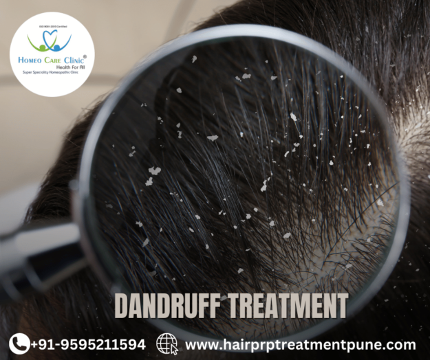 natural home remedies to treat dandruff & itchy scalp Natural dandruff remedies