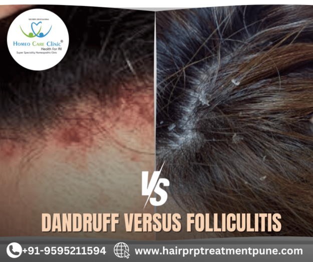 dandruff & folliculitis with expert solutions Dandruff vs. Folliculitis