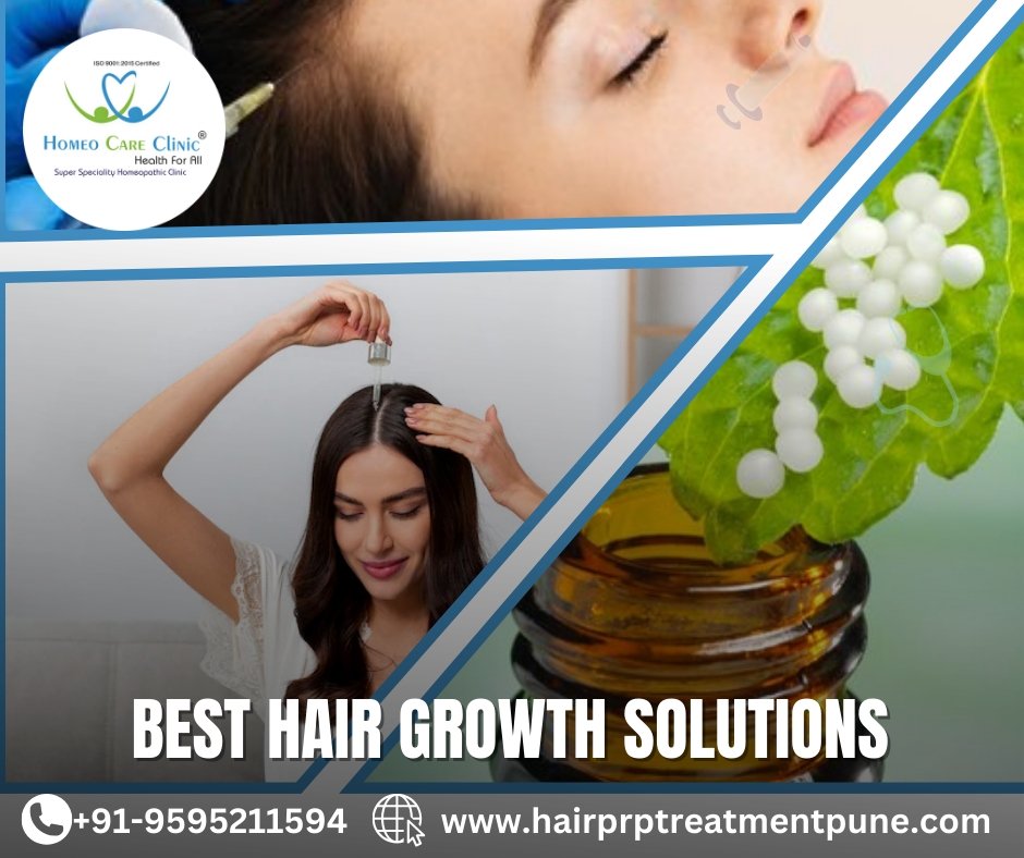 PRP treatment for hair regrowth