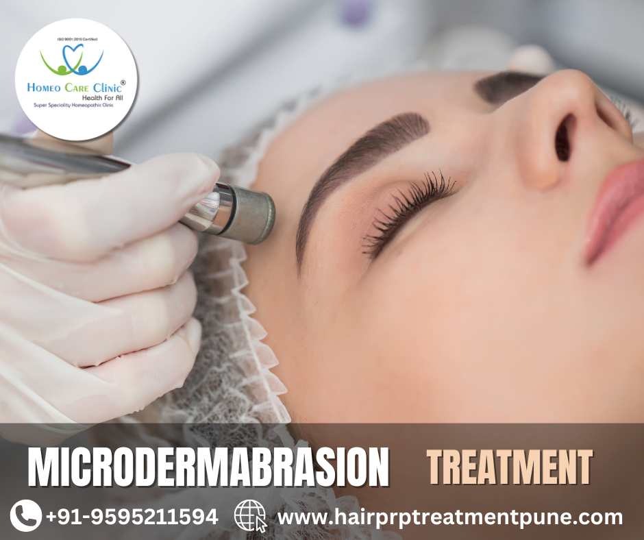 PRP and Microdermabrasion for Acne Scars Microdermabrasion with PRP treatment for acne scars