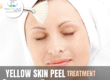 Yellow Peel for Pigmentation and Acne