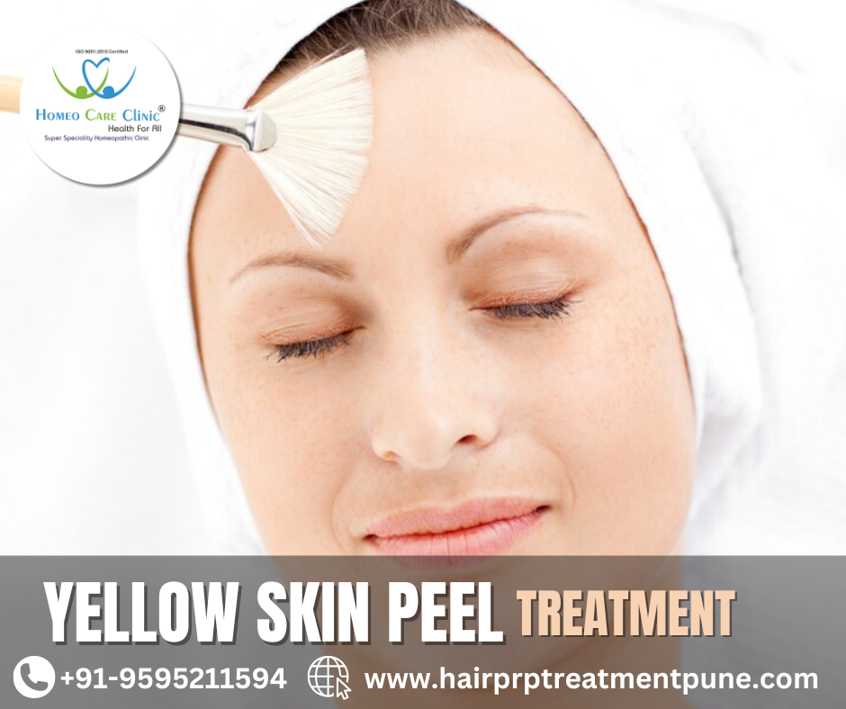 Yellow Peel session targeting facial pigmentation Yellow Peel for Pigmentation and Acne