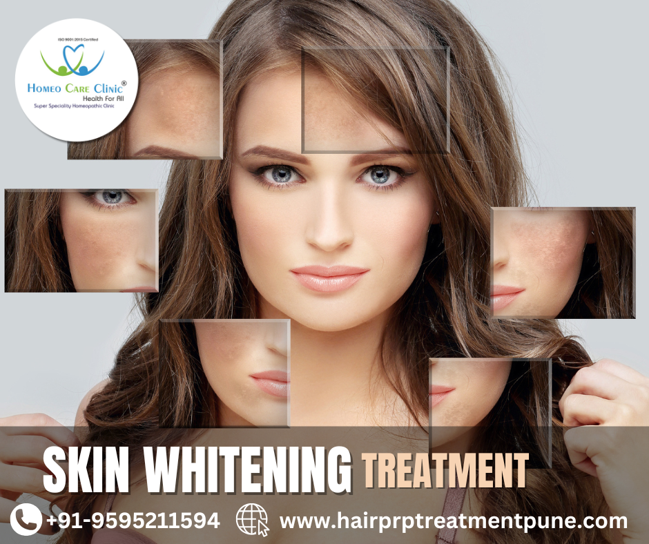 Skin whitening cost, treatment types, and results Skin whitening treatment