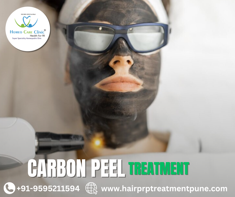 Carbon Peel and Its Natural Healing Support Carbon Peel Laser Treatmen