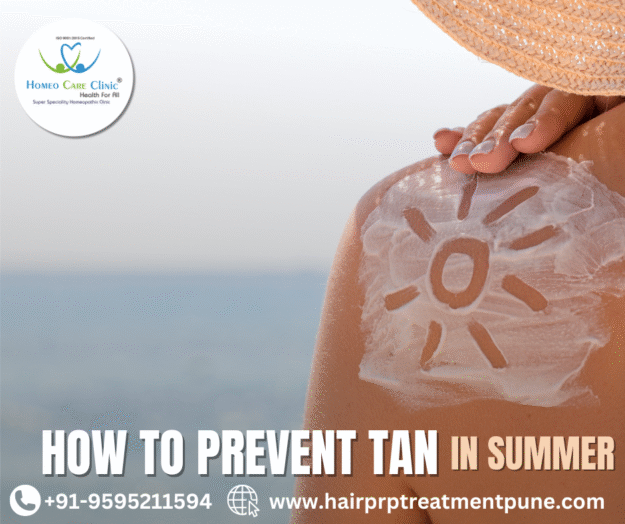 How to prevent tanning in summer with PRP & homeopathy