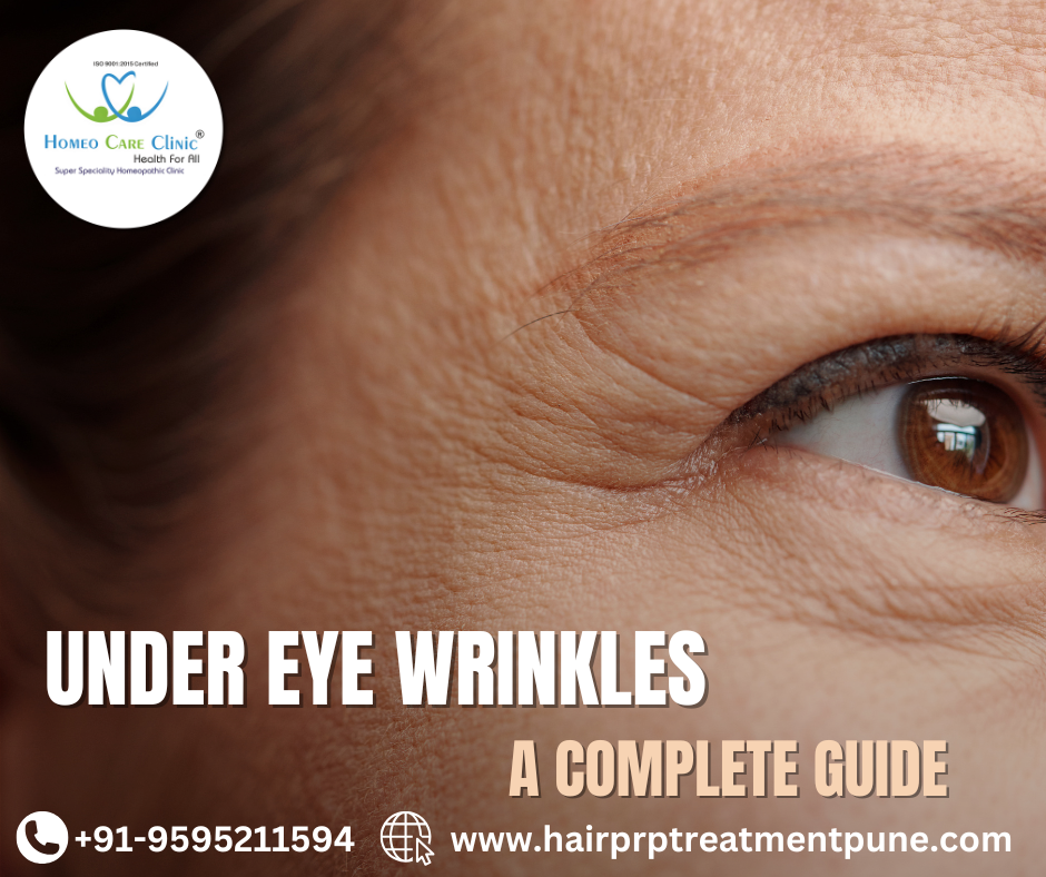 Effective Treatments for Under-Eye Wrinkles treatments for under-eye wrinkles with PRP