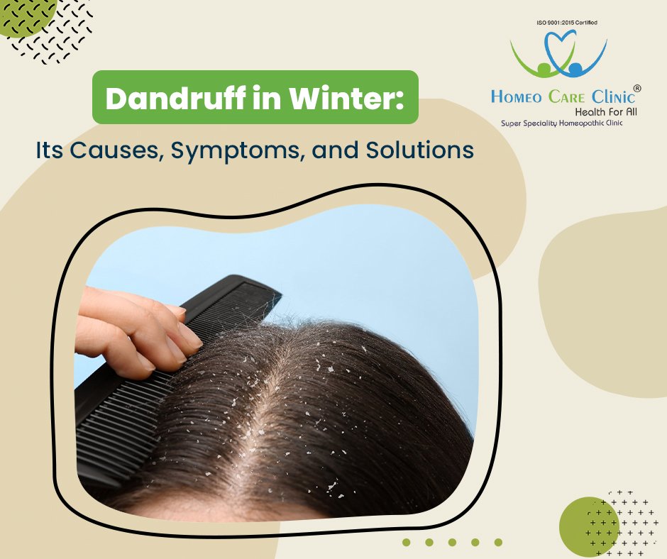 Winter Causes Dandruff