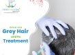 What are Grey hair and Its Treatment