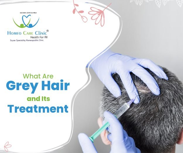 Grey Hair and Different Treatment What are Grey hair and Its Treatment