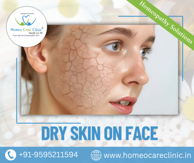 dry skin on face treatment PRP and homeopathy treatment for dry skin on the face