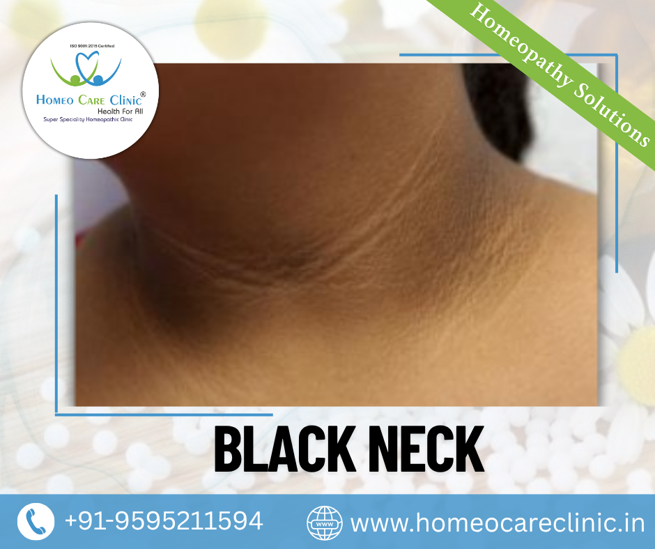 home remedies for black neck black neck treatment