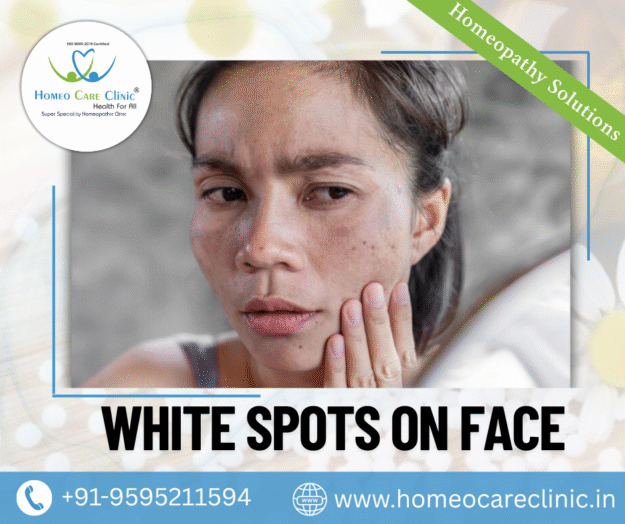 Top Natural Remedies for White Spots on Face how to remove white spots on face