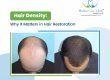 Hair Restoration
