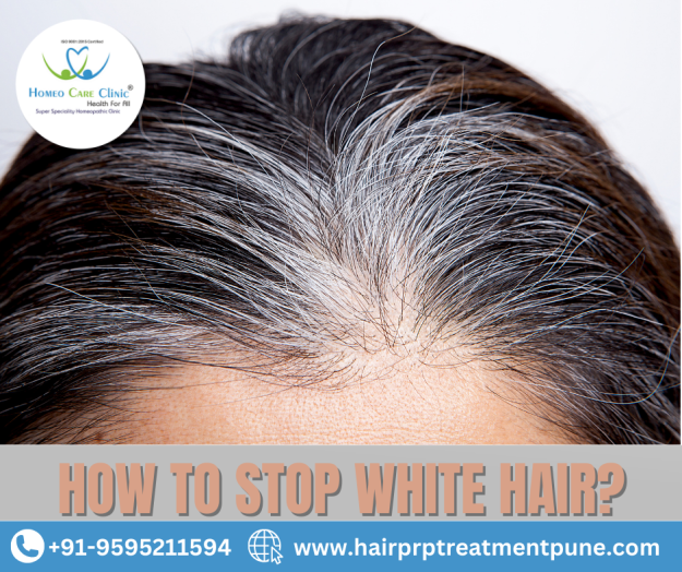White Hair Treatment and Prevention Methods Natural remedies for white hair and prevention methods