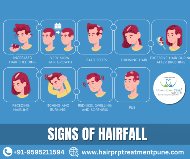 Hair fall causes and PRP treatment options PRP therapy process for hair fall