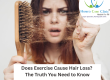 Understand how PRP can help with exercise-related hair loss