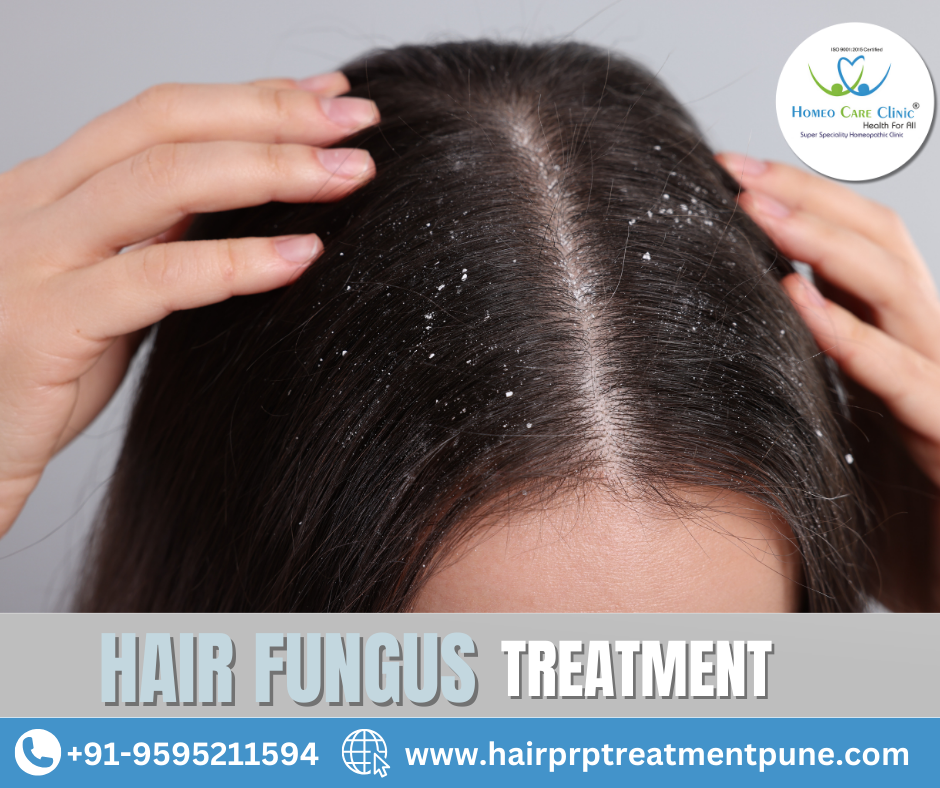 Hair Fungus Treatment for Scalp and Beard Hair Loss Hair fungus treatment for scalp and beard