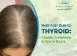 Hair fall due to Thyroid​
