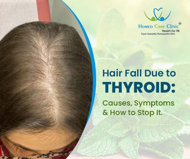 Causes & Symptoms of Hair Fall due to Thyroid Hair fall due to Thyroid