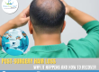 hair loss after surgery