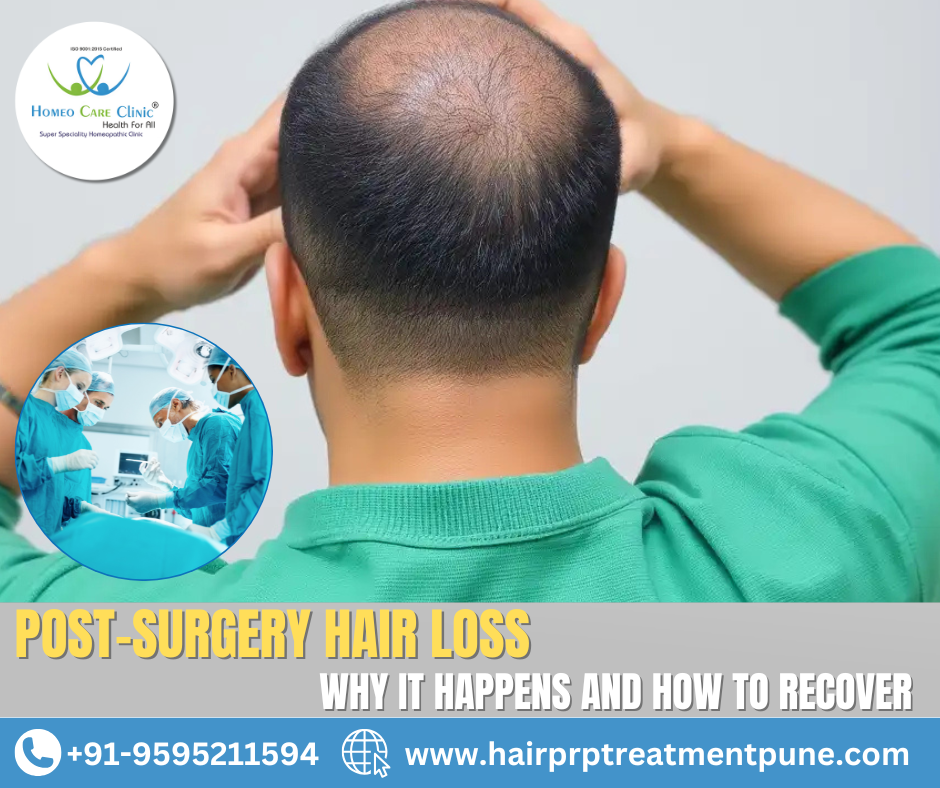 how to prevent hair loss after surgery hair loss after surgery