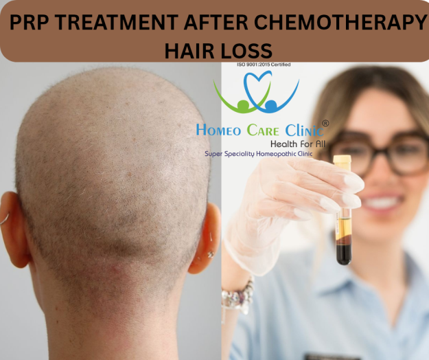 chemotherapy hair loss and PRP benefits chemotherapy with hair regrowth after PRP therapy