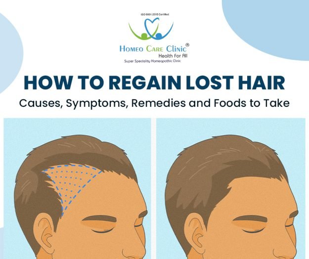 How to Regain Lost Hair