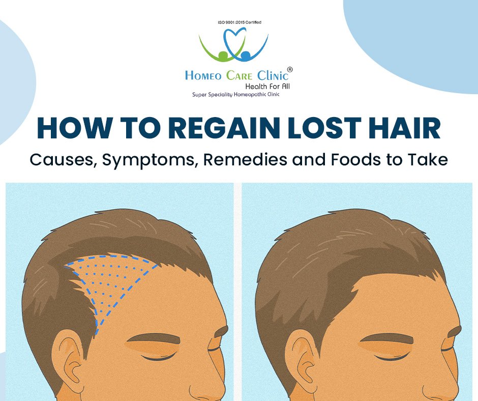 How to Regain Lost Hair