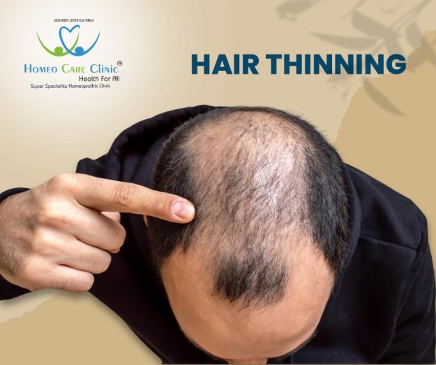 Hair Thinning: Causes, Reasons and Treatment