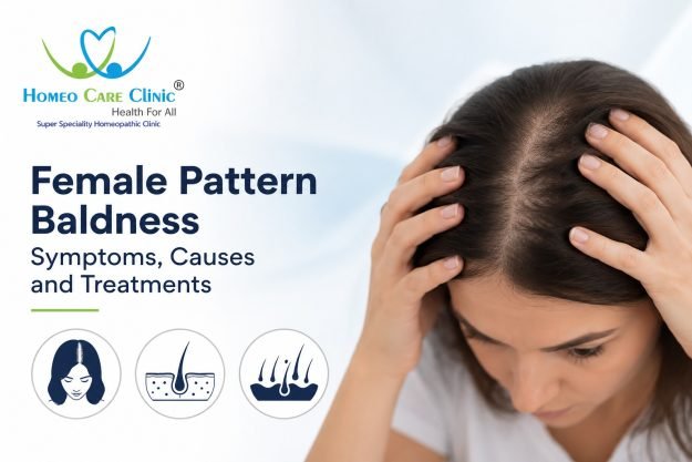 Female Pattern Baldness – Symptoms, Causes, and Treatments Female Pattern Baldness – Symptoms, Causes, and Treatments