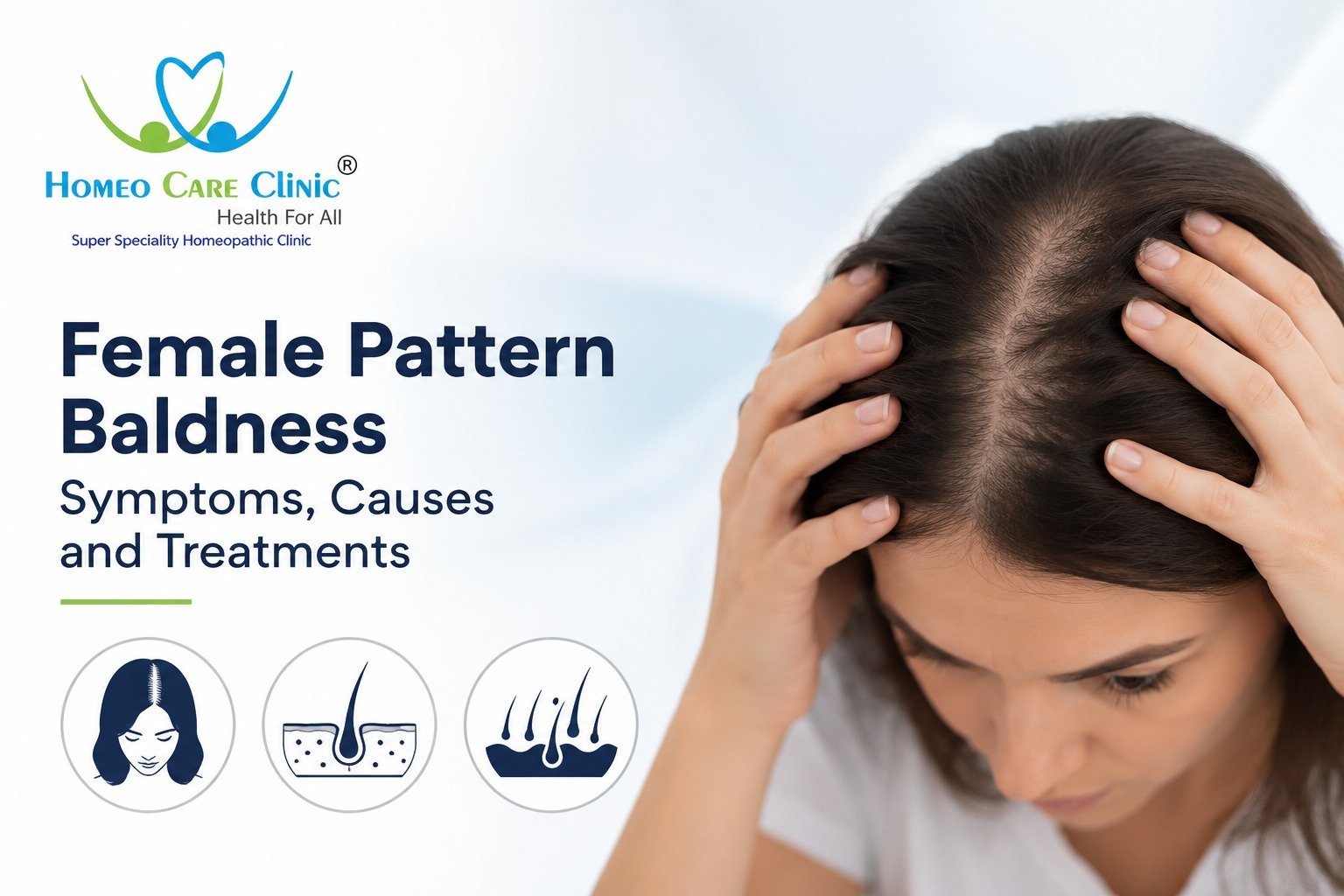 Female Pattern Baldness – Symptoms, Causes, and Treatments Female Pattern Baldness – Symptoms, Causes, and Treatments