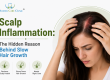 Scalp Inflammation Hair Loss: Causes, Treatment & Hair Growth
